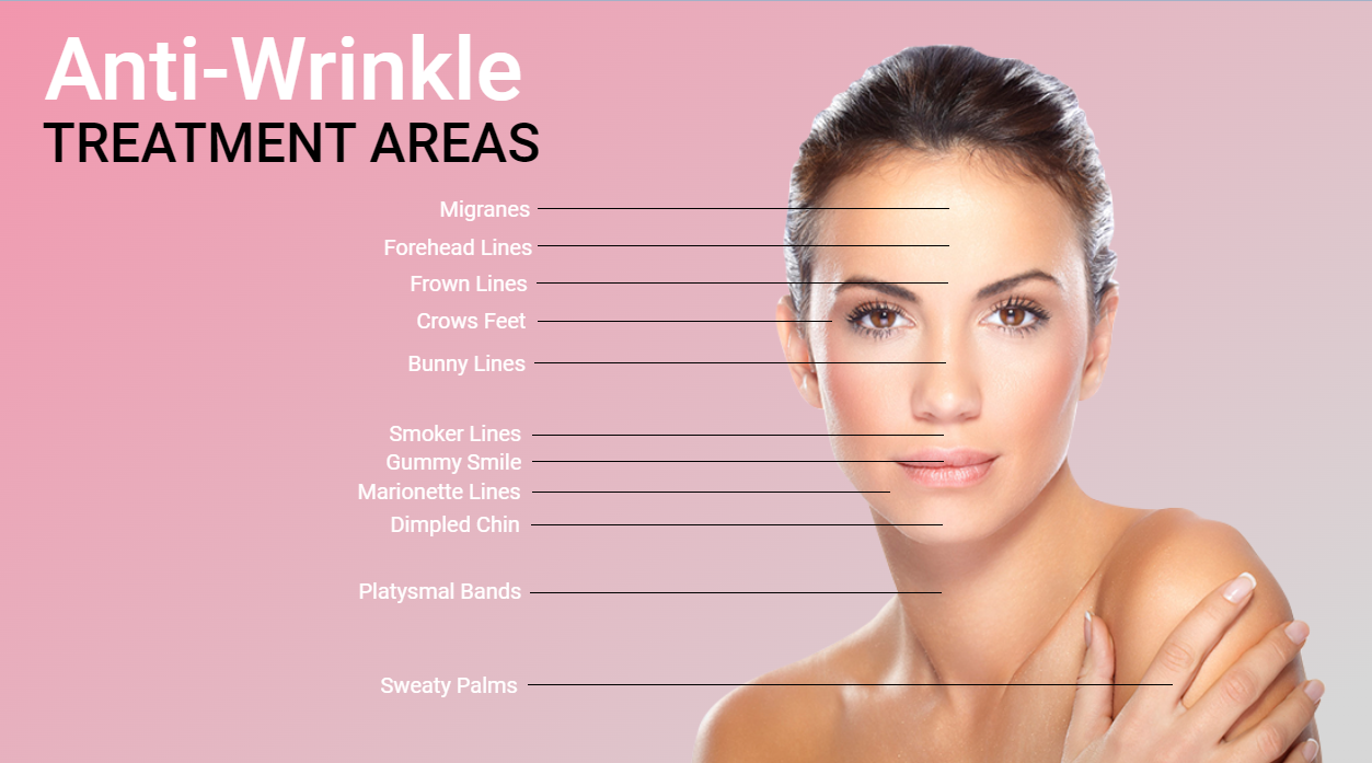 Anti Wrinkle treatment areas
