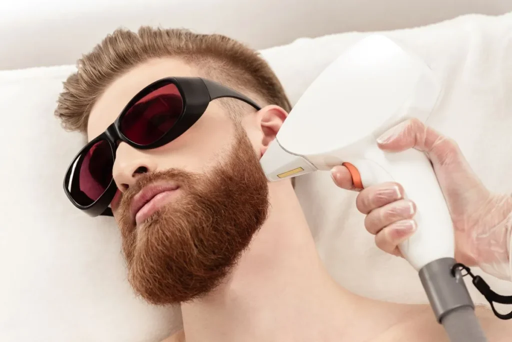 man getting beard line and neck laser treated