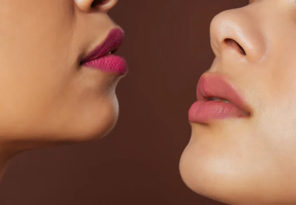 two women with lip fillers