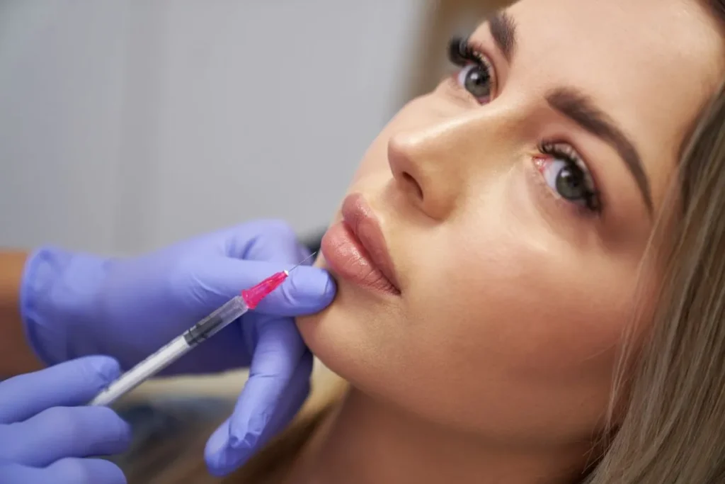 Lip Filler Benefits: Enhancing Volume, Shape and Proportion
